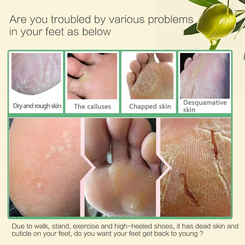 Exfoliating Foot Mask for Dead Skin and Moisture Care