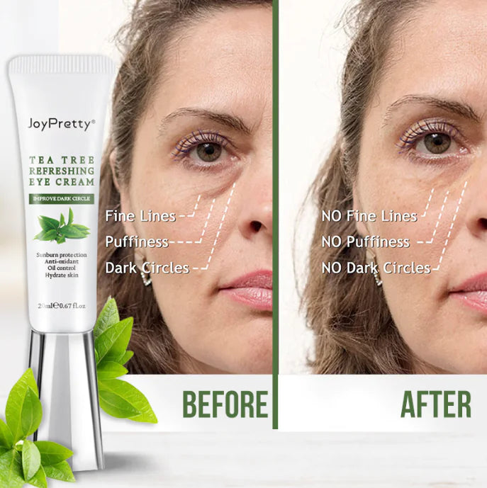 Pimple Removal Facial Skin Care for Oily Skin (One Item)