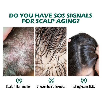 Scalp Deep Cleansing Oil 30ml